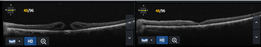 Slider image (10) Dr Nikolaos I Dervenis Eye Clinic